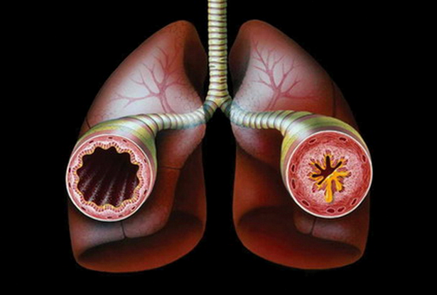 health-astma